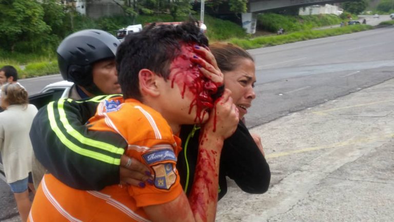 Discapacidad por armas de fuego | Politáchira deja ciego a Rufo Chacón.